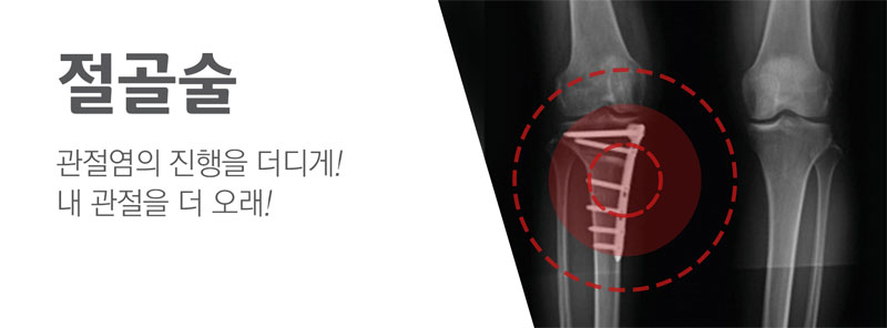 절골술